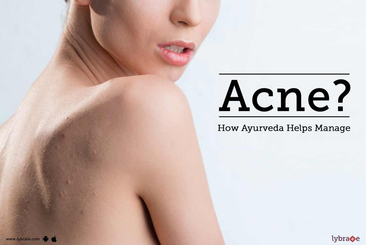 How Ayurveda Helps Manage Acne?