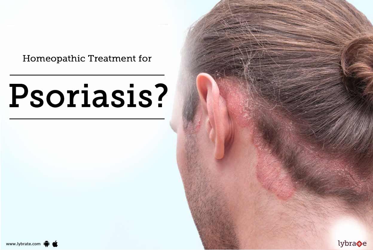 Homeopathic Treatment for Psoriasis