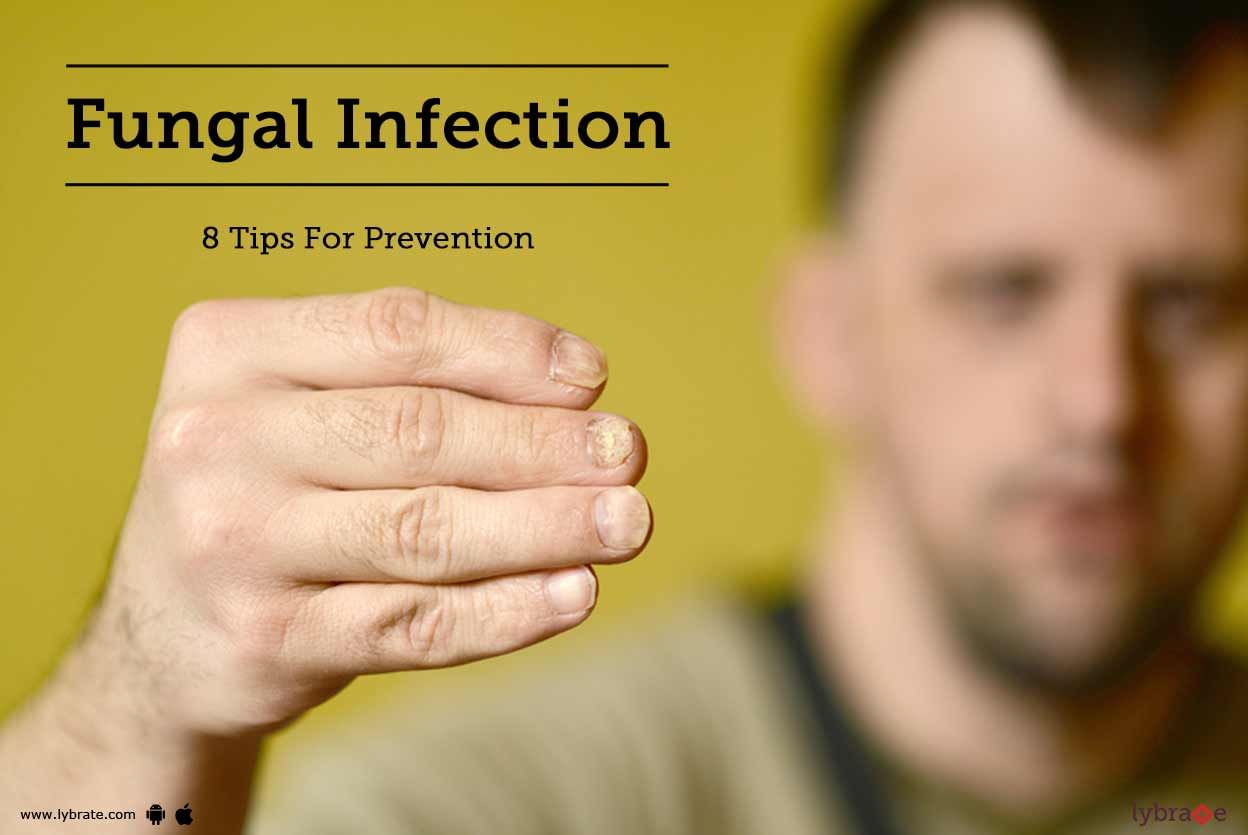 Fungal Infection - 8 Tips For Prevention