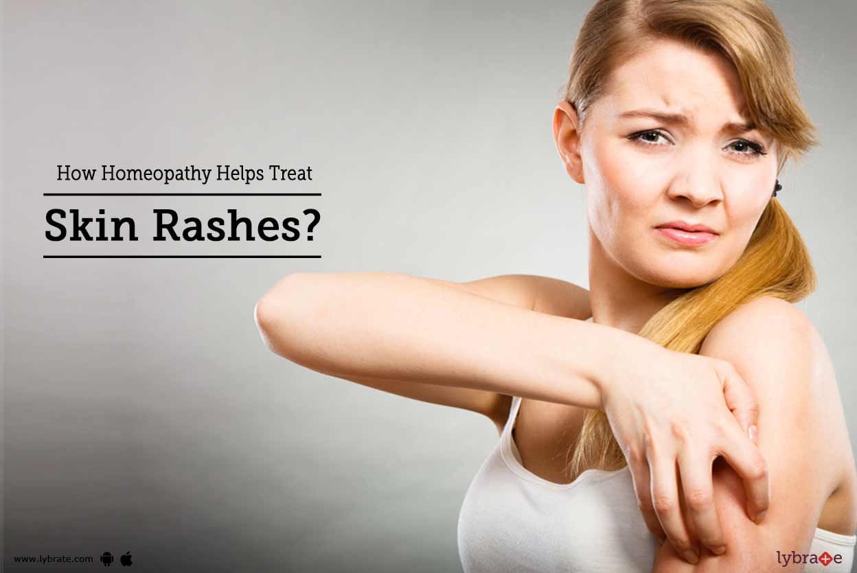 How Homeopathy Helps Treat Skin Rashes?