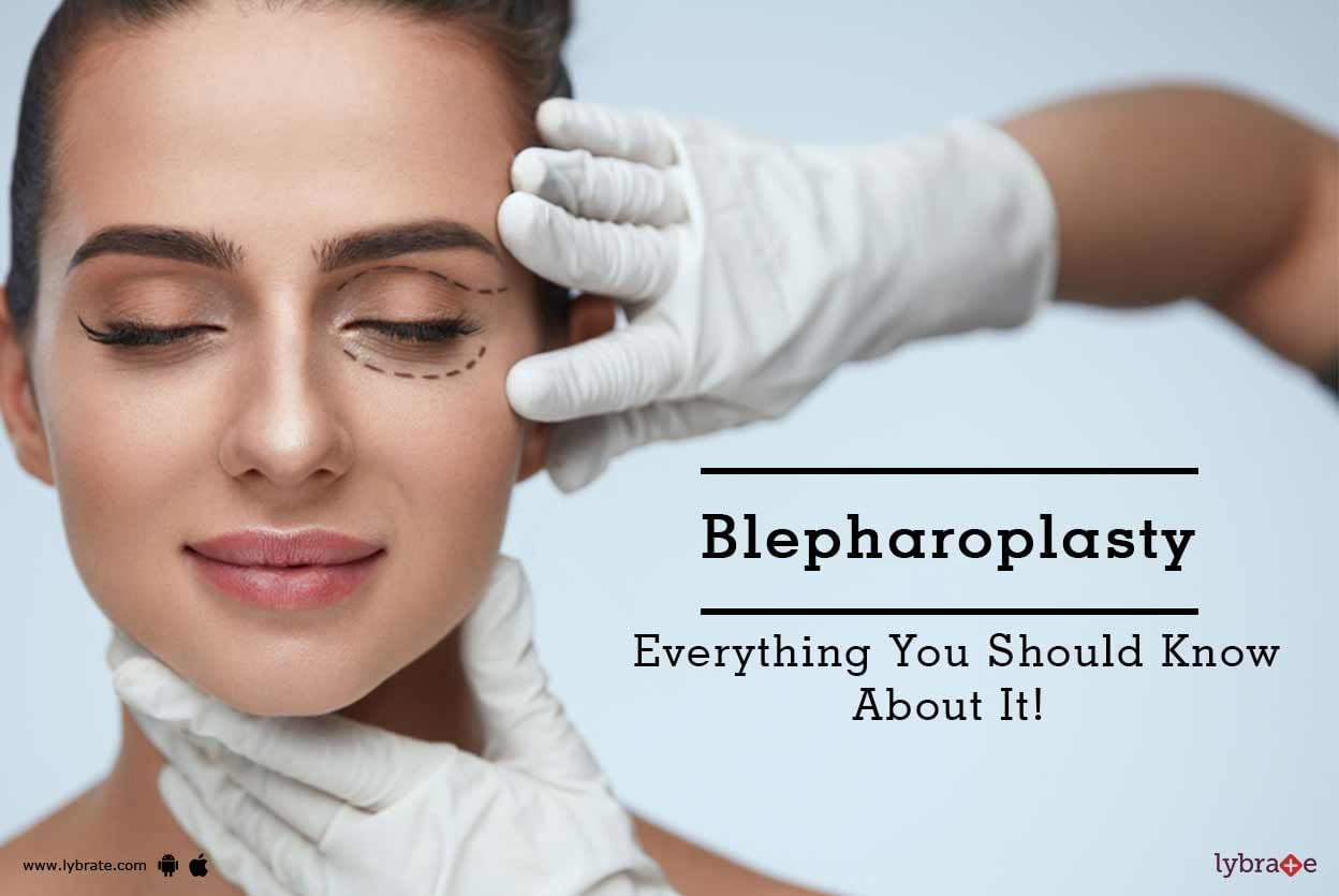 Blepharoplasty - Everything You Should Know About It!