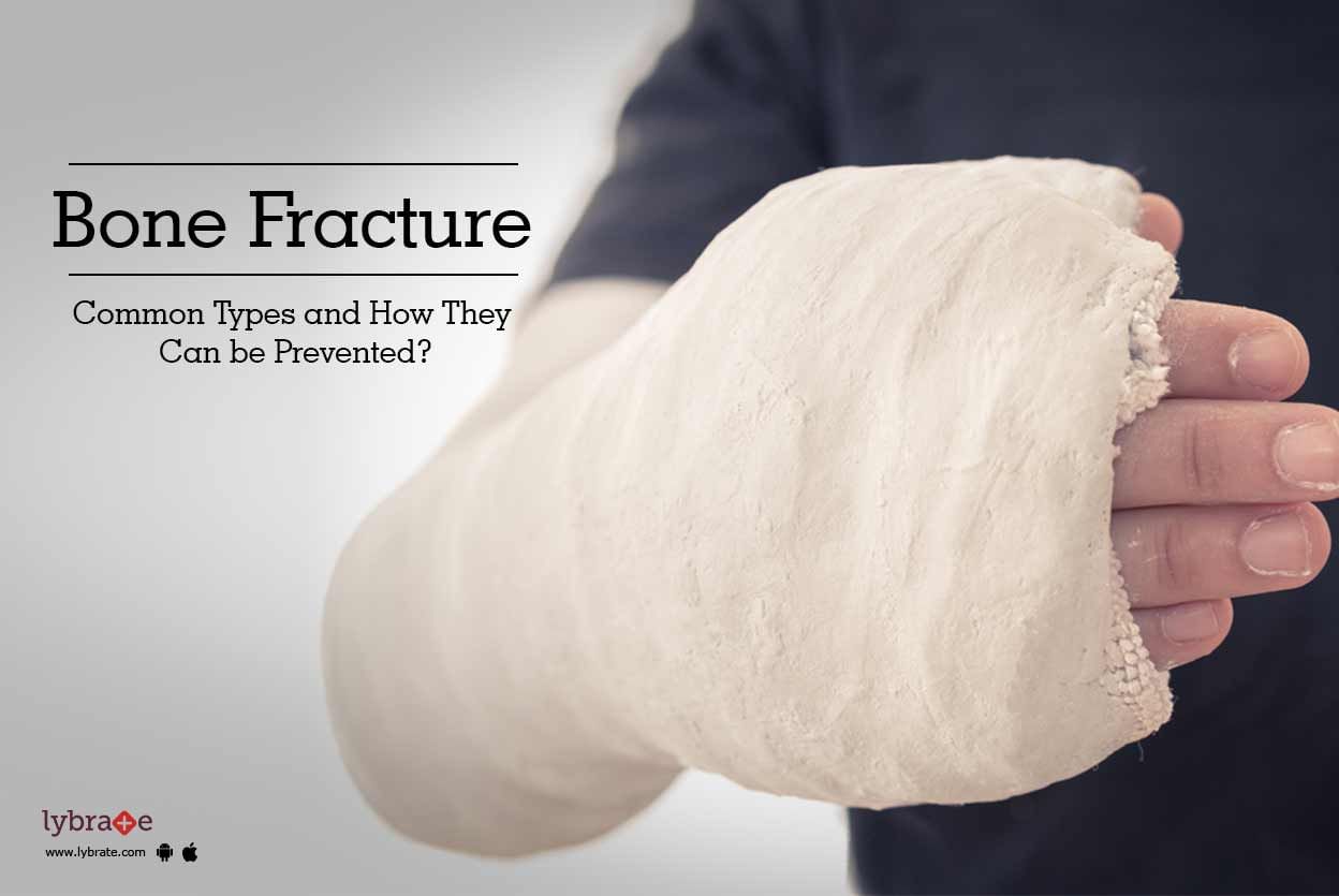 Bone Fracture - Common Types and How They Can be Prevented?