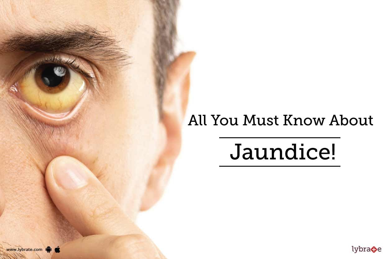 All You Must Know About Jaundice!