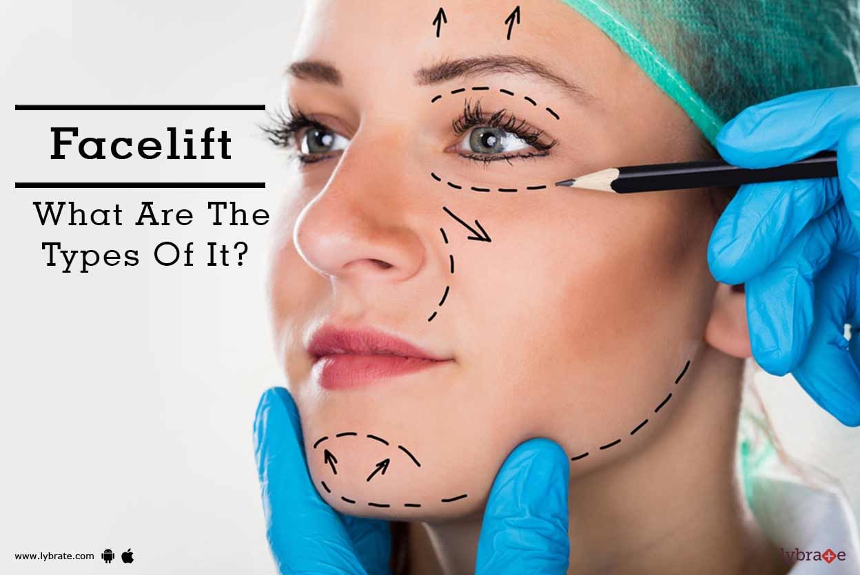 Facelift - What Are The Types Of It?