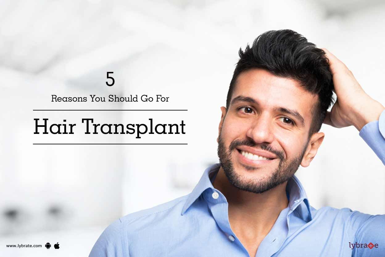 5 Reasons You Should Go For Hair Transplant