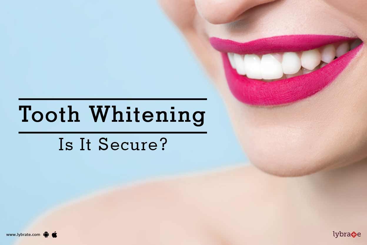 Tooth Whitening - Is It Secure?