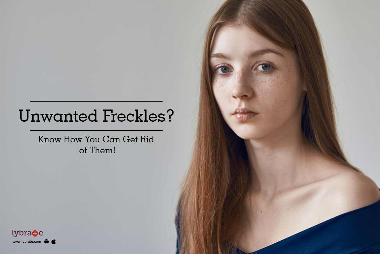 Unwanted Freckles? Know How You Can Get Rid of Them!
