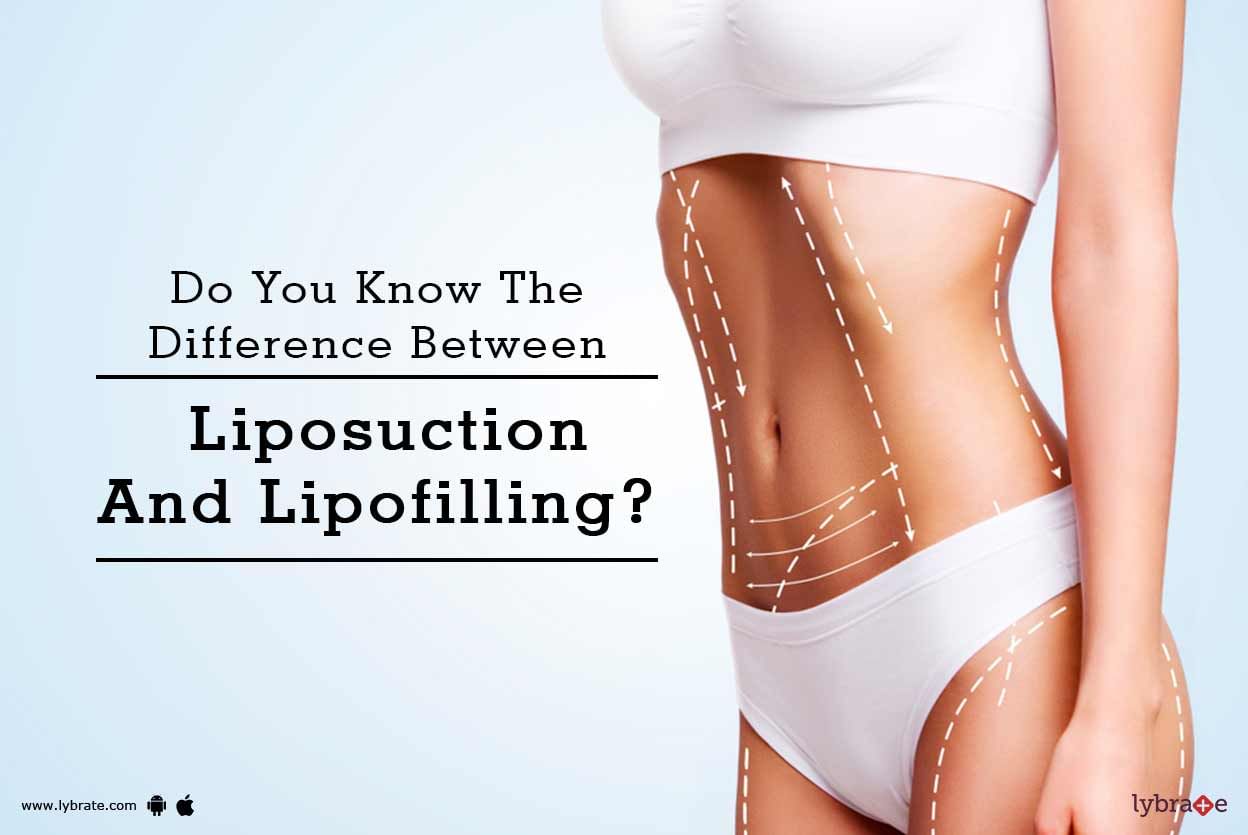 Do You Know The Difference Between Liposuction And Lipofilling?