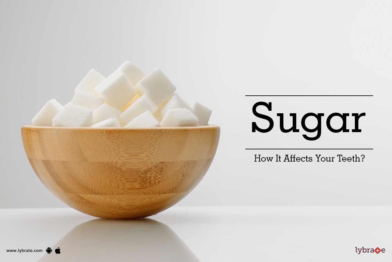 Sugar - How It Affects Your Teeth?