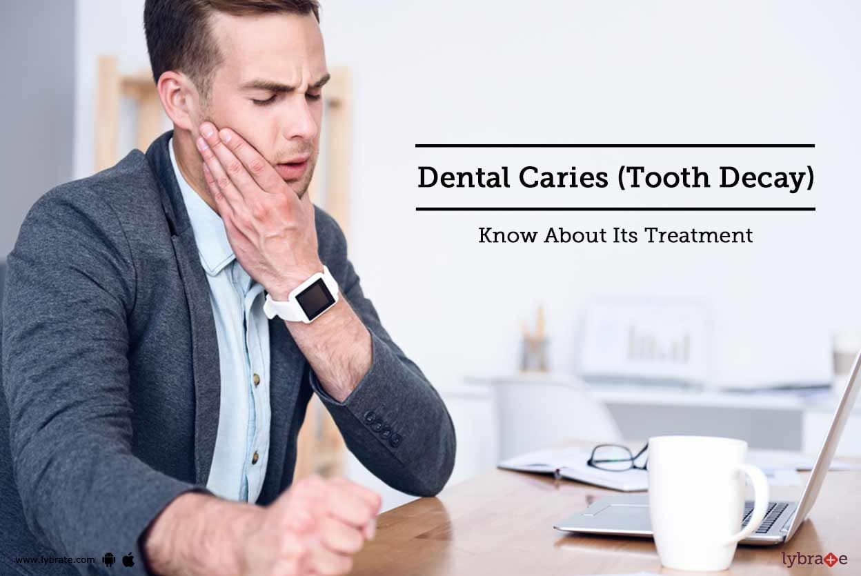 Dental Caries (Tooth Decay) - Know About Its Treatment
