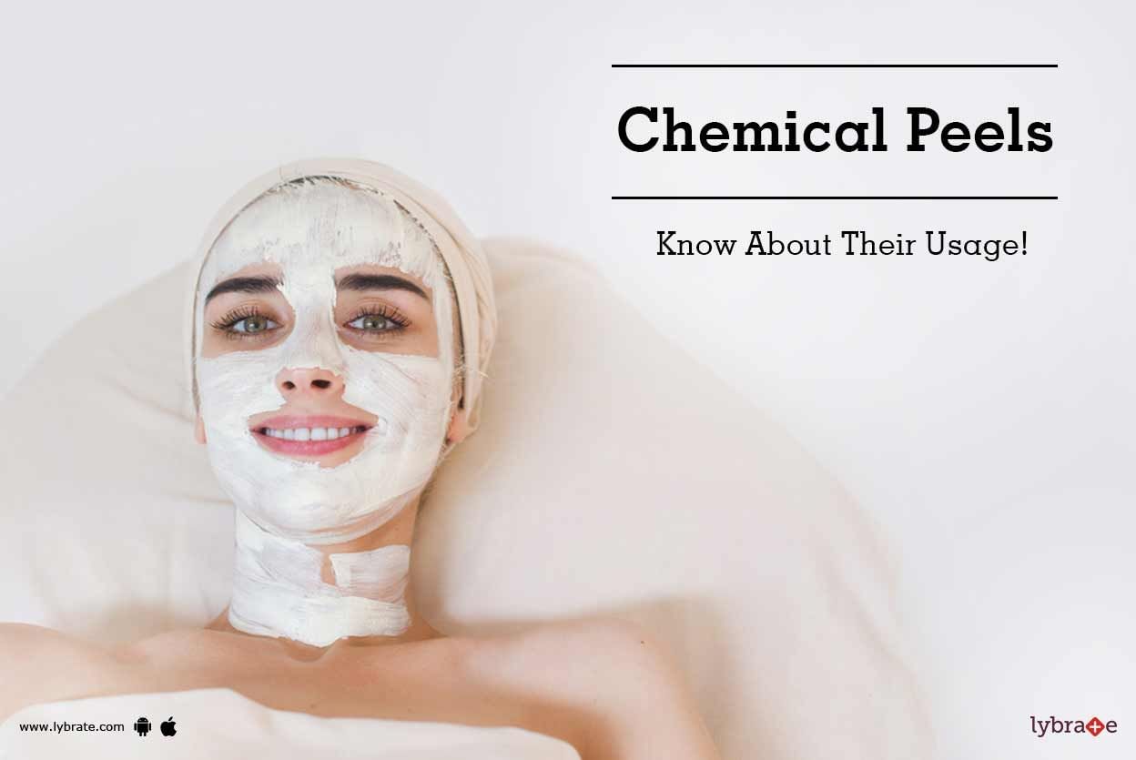 Chemical Peels - Know About Their Usage!