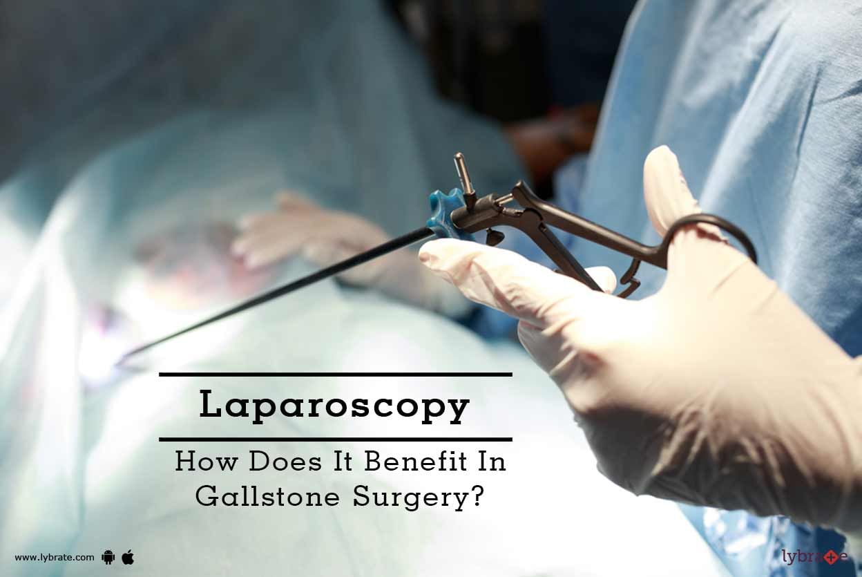 Laparoscopy - How Does It Benefit In Gallstone Surgery?