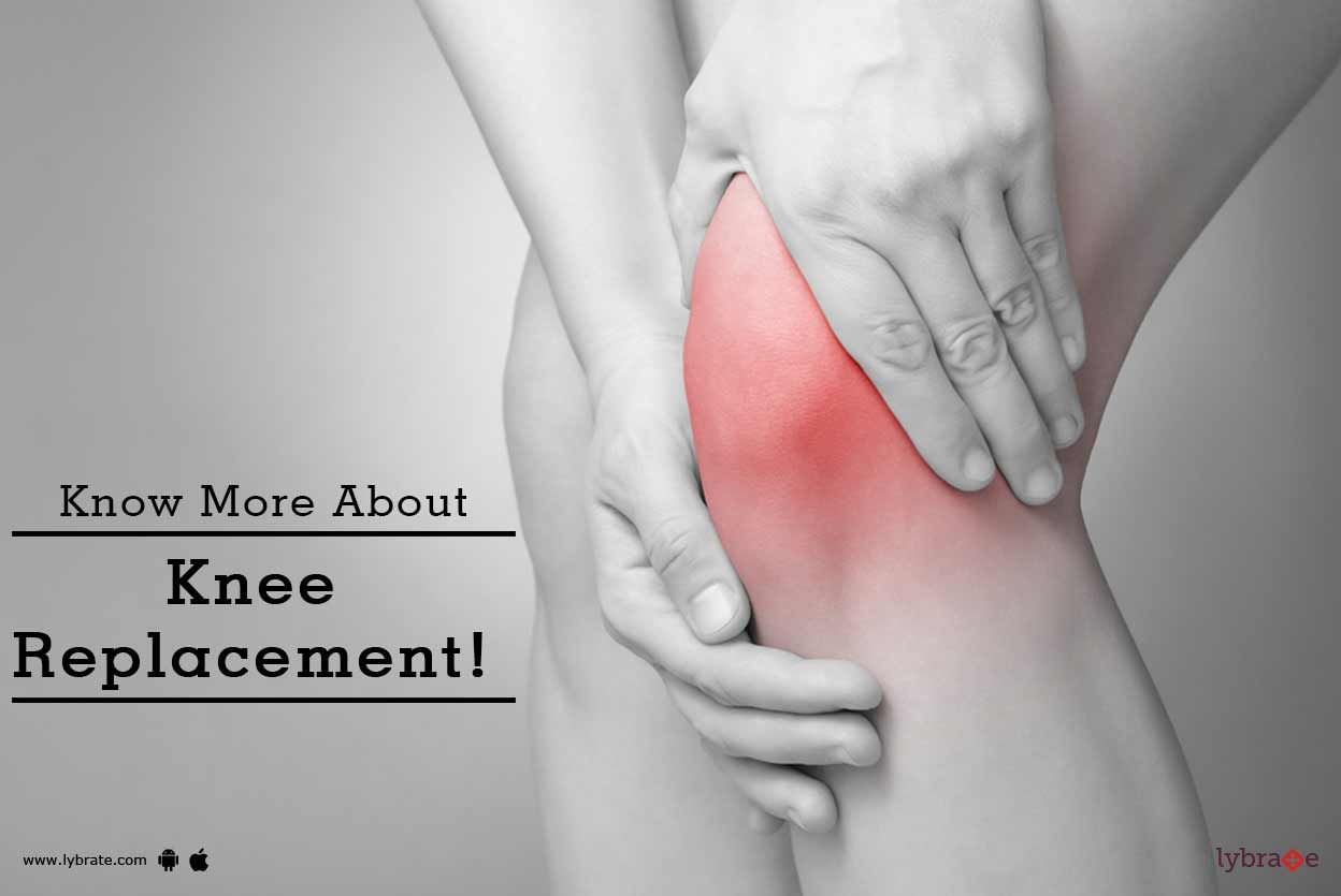 Know More About Knee Replacement!