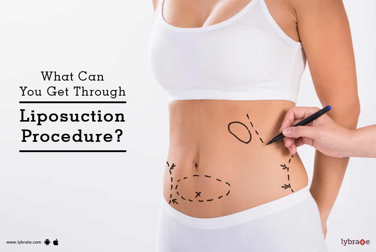 What Can You Get Through Liposuction Procedure?