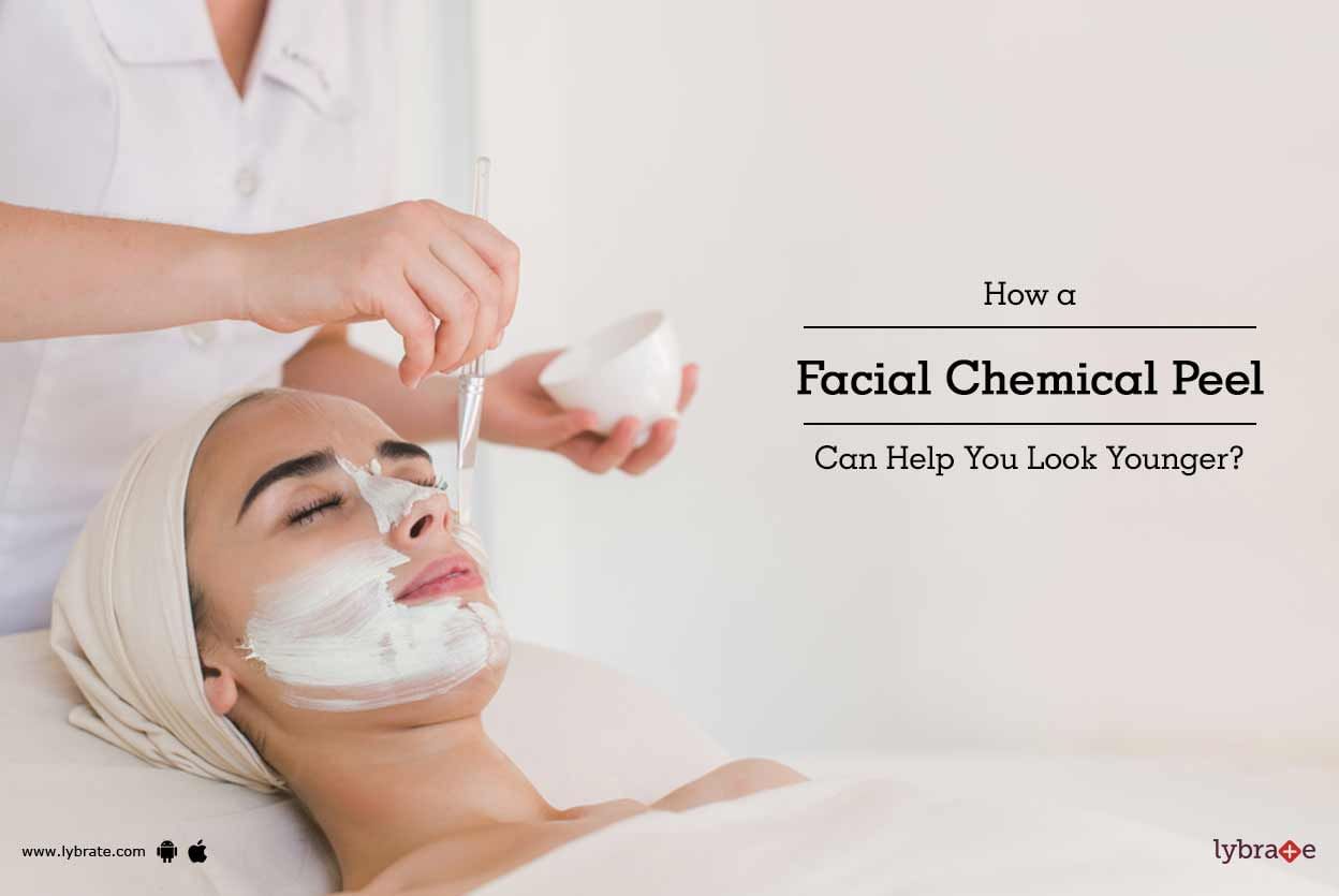 How a Facial Chemical Peel Can Help You Look Younger?