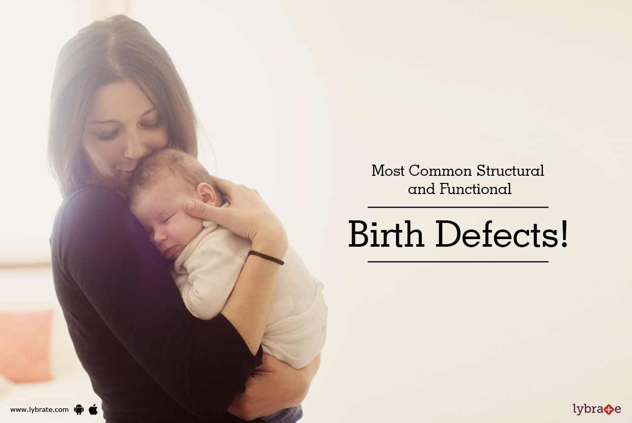 Most Common Structural and Functional Birth Defects!