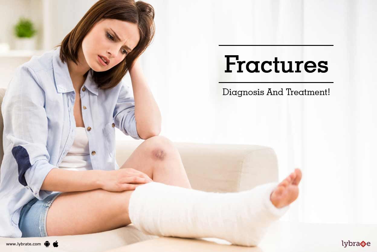 Fractures - Diagnosis And Treatment!