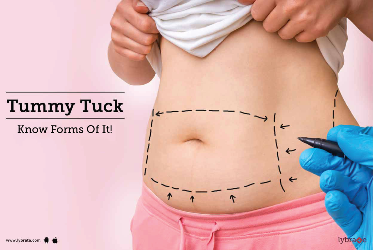 Tummy Tuck - Know Forms Of It!