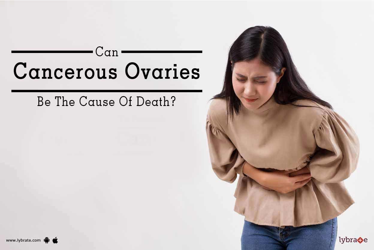 Can Cancerous Ovaries Be The Cause Of Death?
