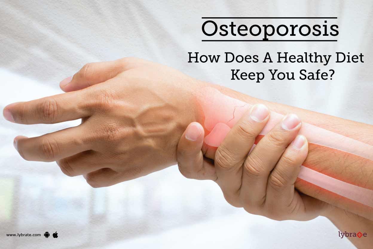 Osteoporosis - How Does A Healthy Diet Keep You Safe?