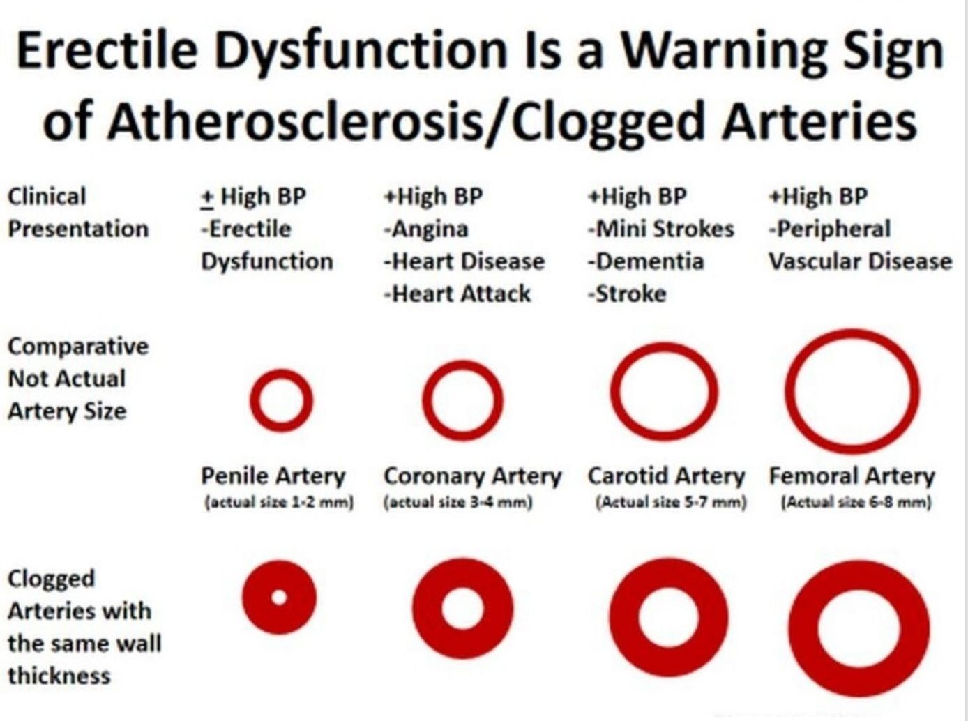 Erectile Dysfunction - How Can Diabetes Affect?