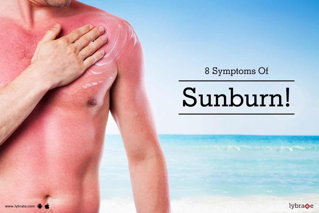 8 Symptoms Of Sunburn!