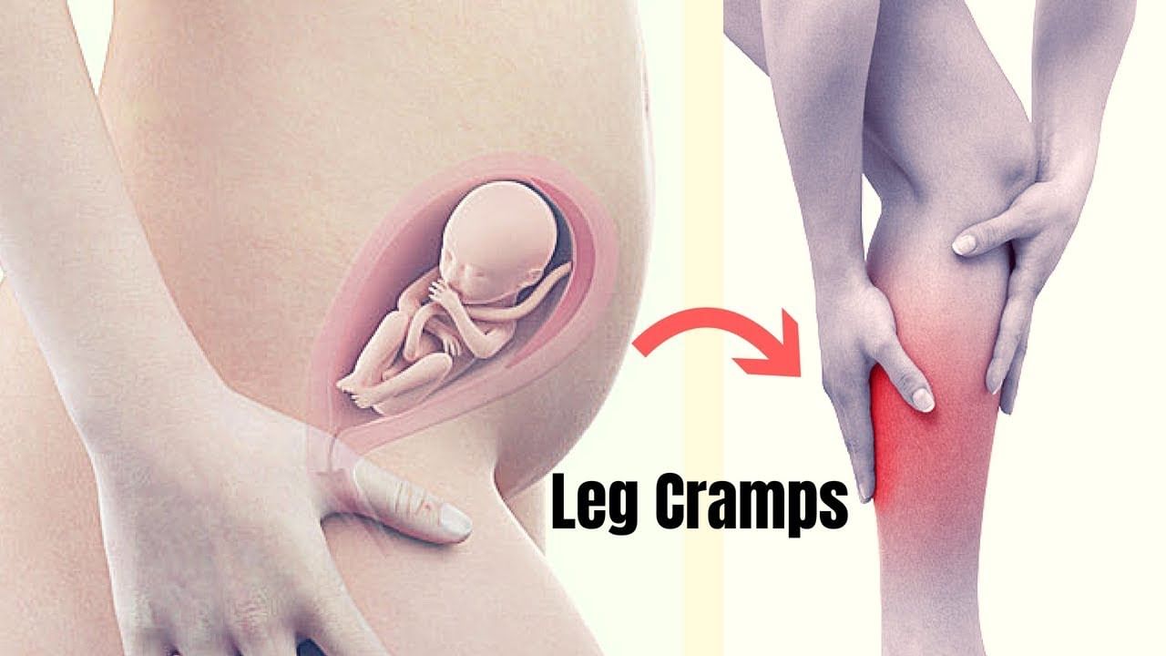 Leg Cramps during pregnancy