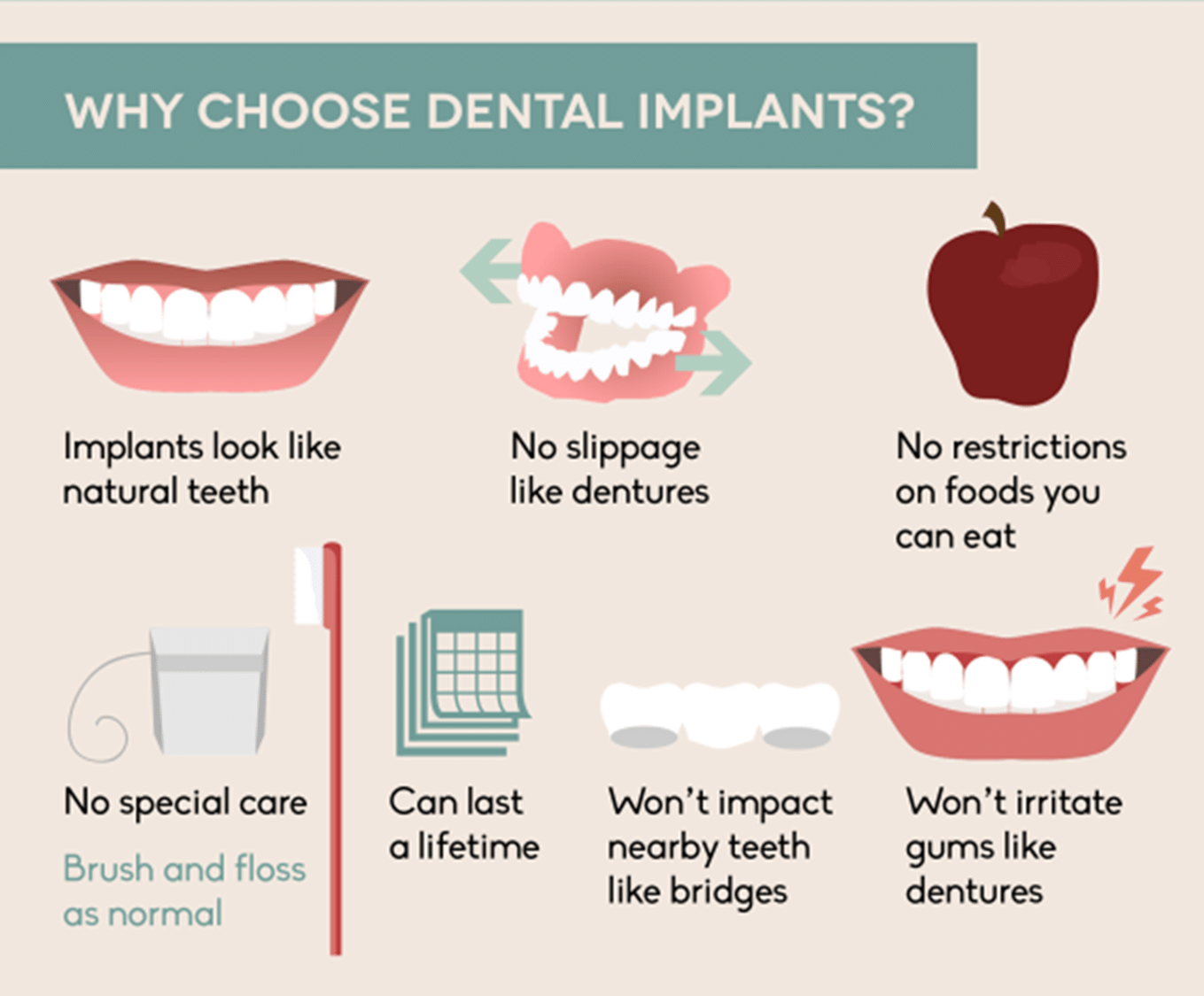 What do Dental Implants Really Cost?