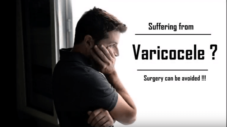 What You Need To Know About Varicocele?