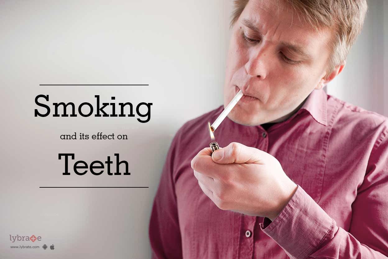 Smoking and Its Effect on Teeth