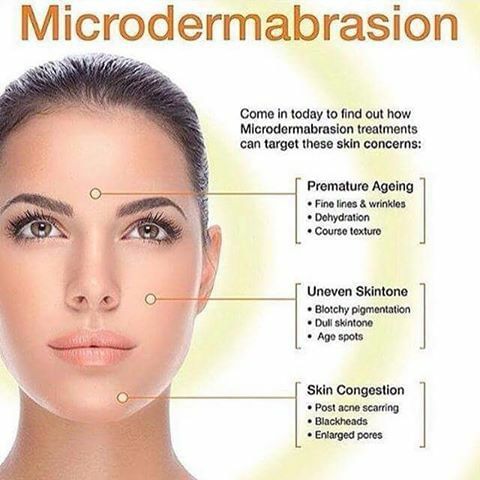 Know About Microdermabrasion