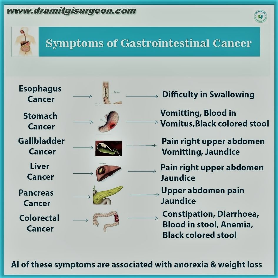 Know More About Gastrointestinal Cancer Symptoms!