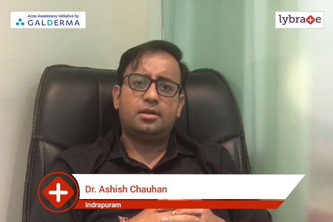 Lybrate | Dr Ashish Chauhan speaks on IMPORTANCE OF TREATING ACNE EARLY