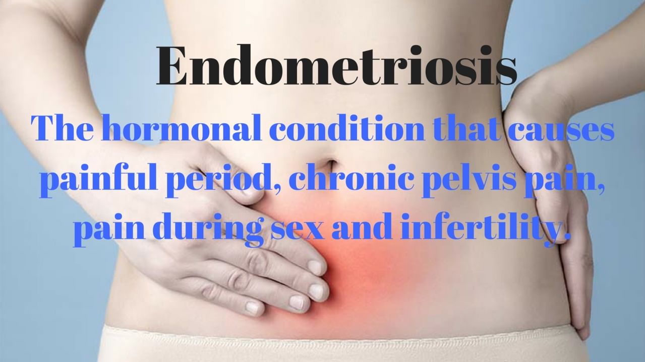 5 factors That Can Cause Endometriosis