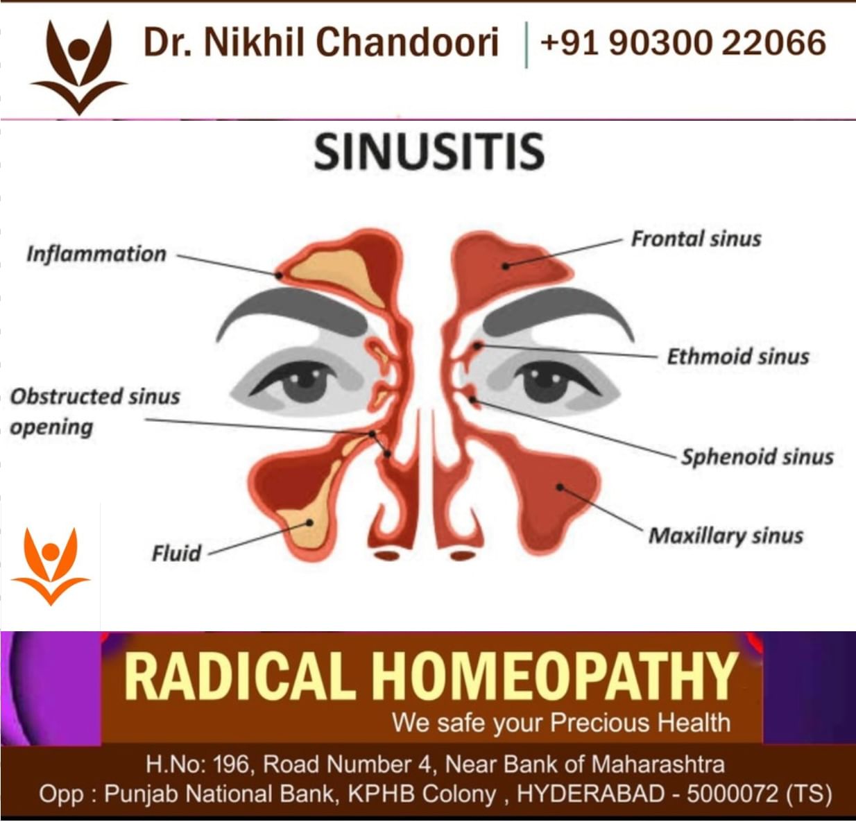 Best Homeopathic Treatment for sinusitis