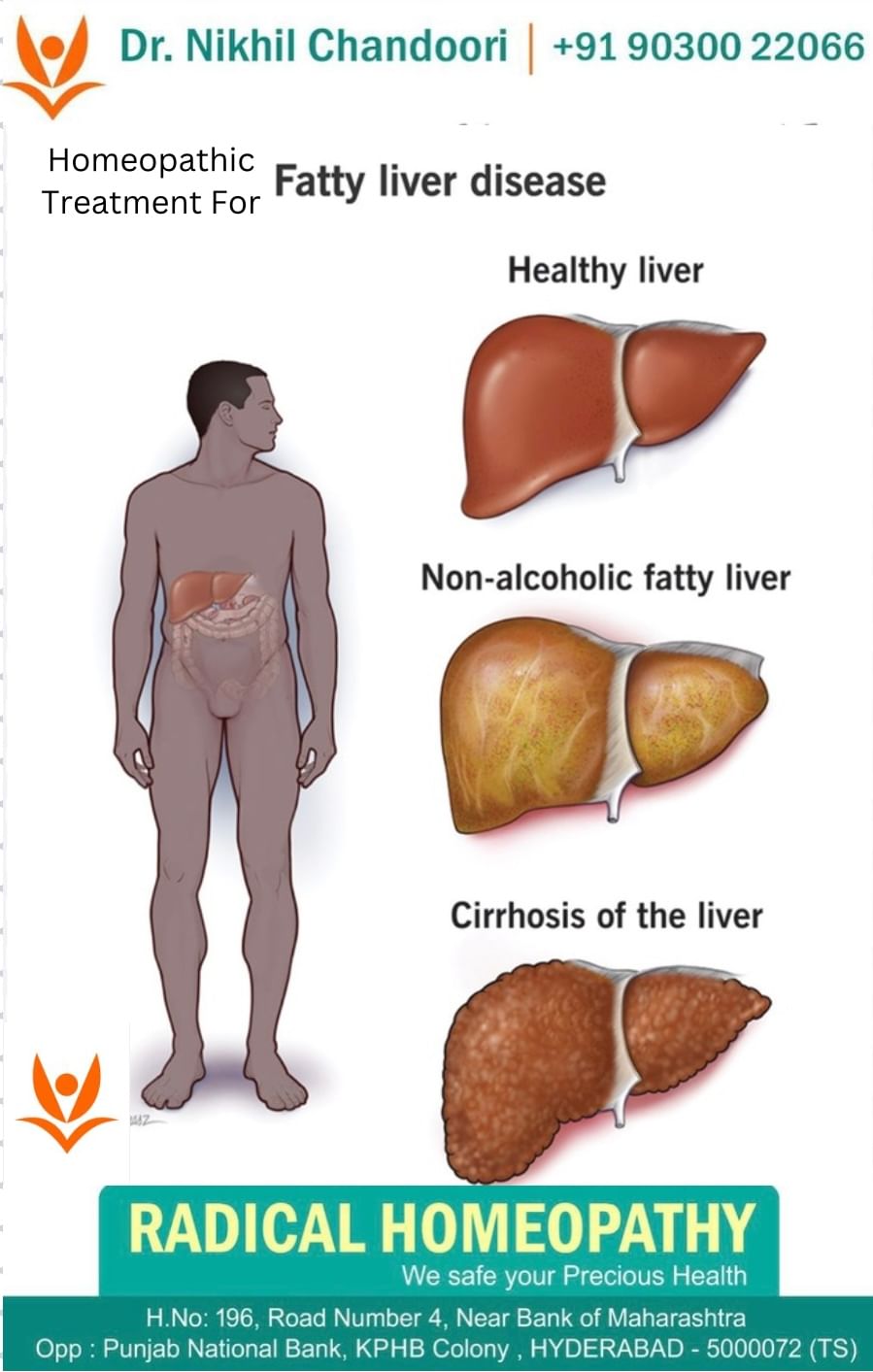 Best Homeopathic Treatment For Fatty liver.