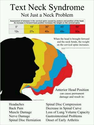 Are Tech devices causing neck pain...please read: TEXT NECK SYNDROME...