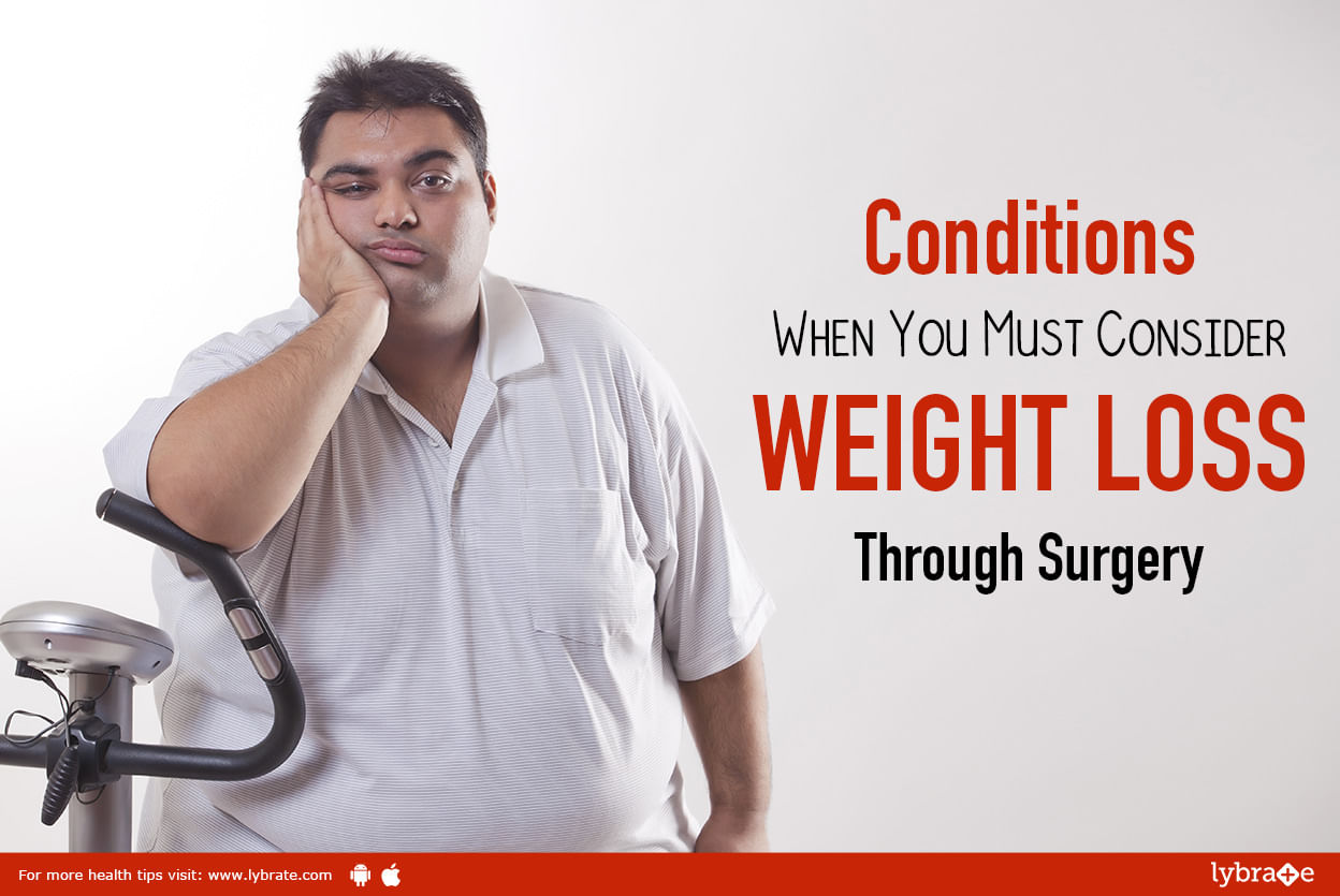 Conditions When You Must Consider WEIGHT LOSS Through Surgery
