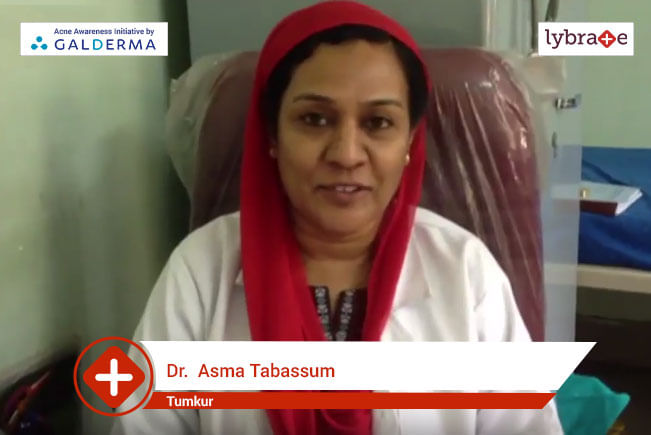 Lybrate | Dr. Asma Tabassum speaks on IMPORTANCE OF TREATING ACNE EARLY