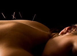 5 better ways ACUPUNCTURE can make you stronger !