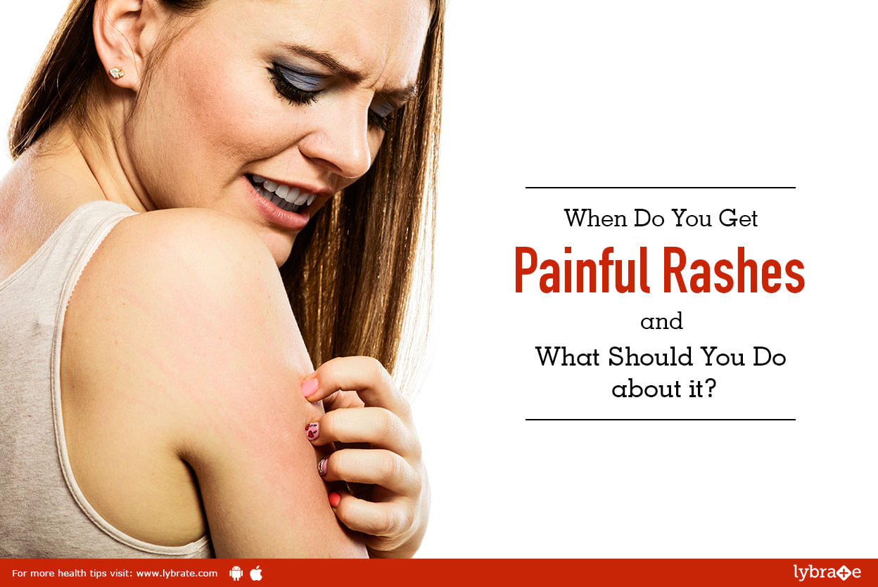 When Do You Get Painful Rashes and What Should You Do about it?