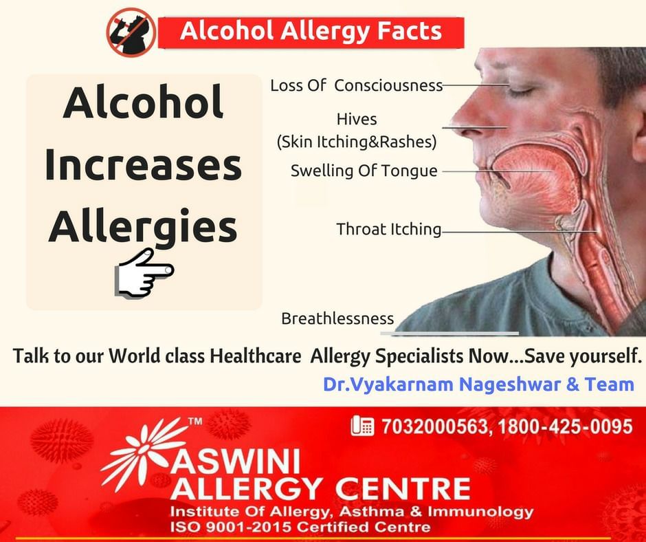Know More About Allergies