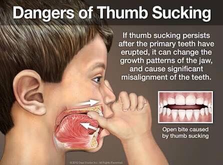 Dangers Of Thumb Sucking