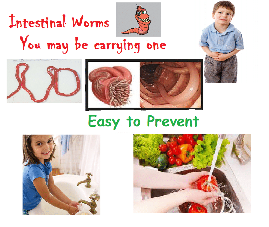 Intestinal Worms – A silent Disease " You may be carrying one"