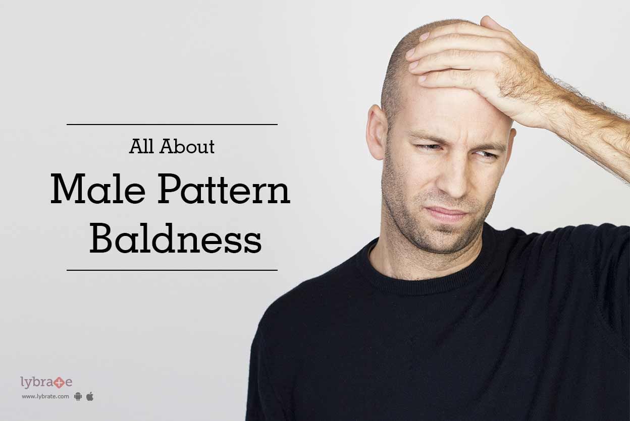 All About Male Pattern Baldness