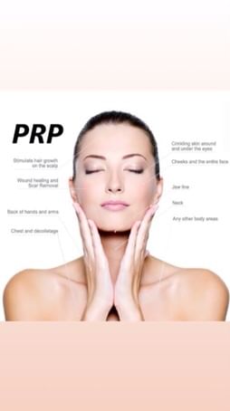 Vampire Facial (PRP) - Know More About It!