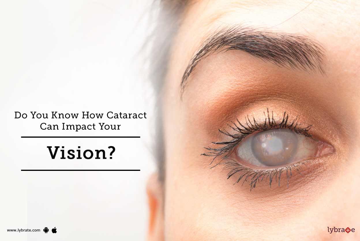 Do You Know How Cataract Can Impact Your Vision?