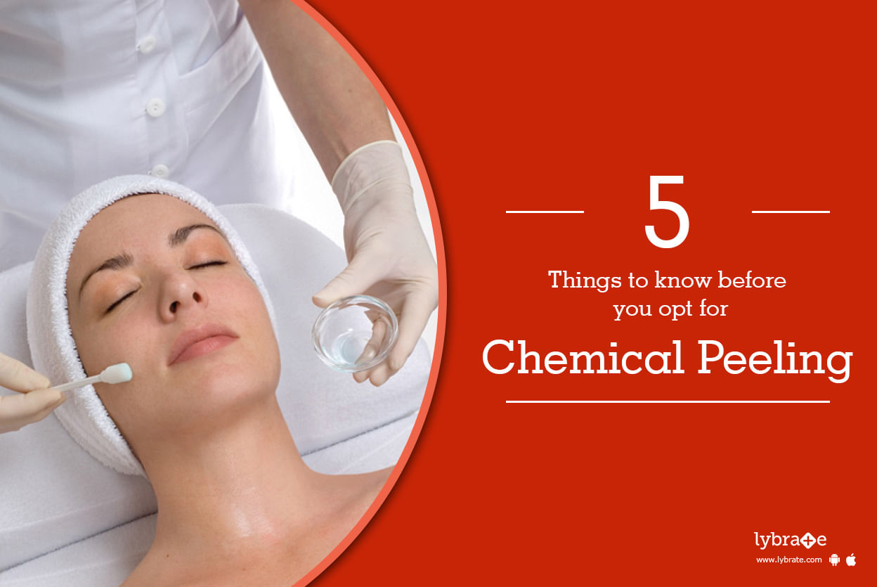 5 Things to know before you opt for chemical peeling