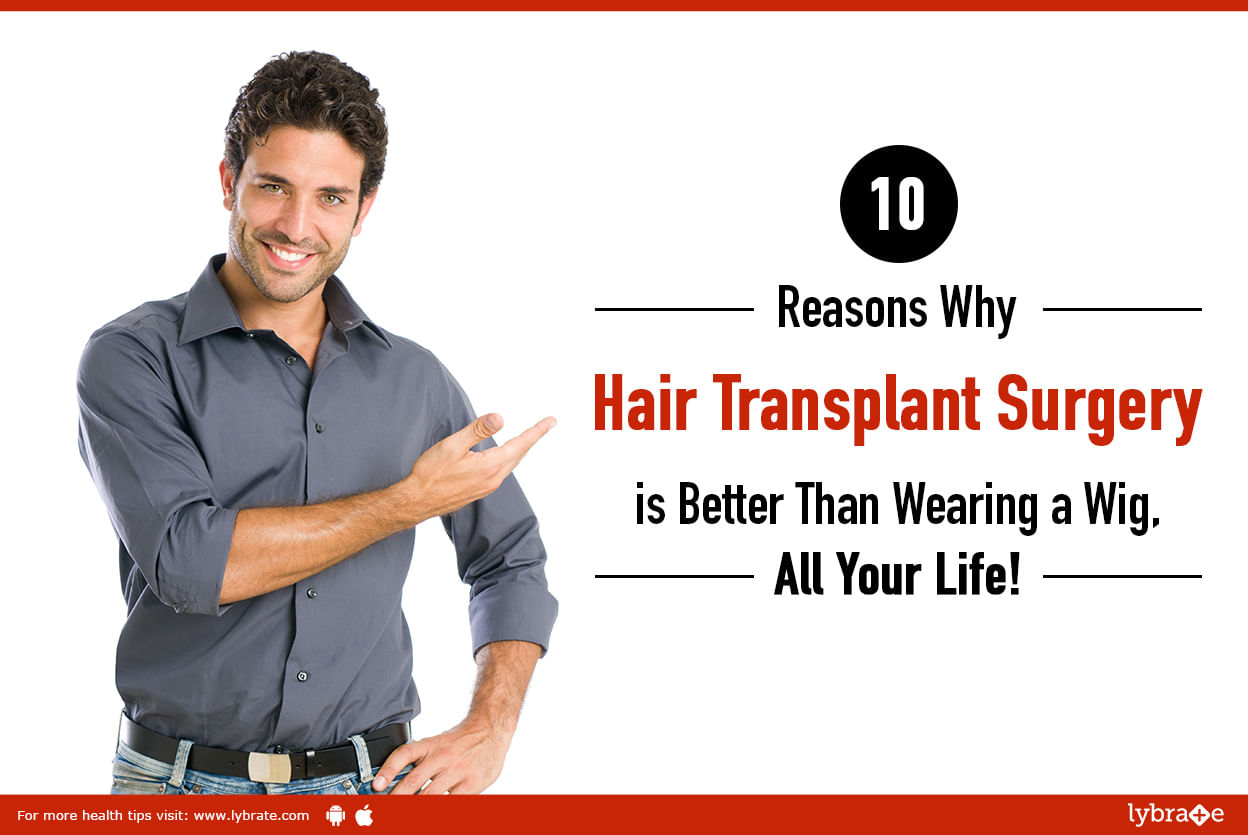 10 Reasons Why Hair Transplant Surgery is Better Than Wearing a Wig, All Your Life!