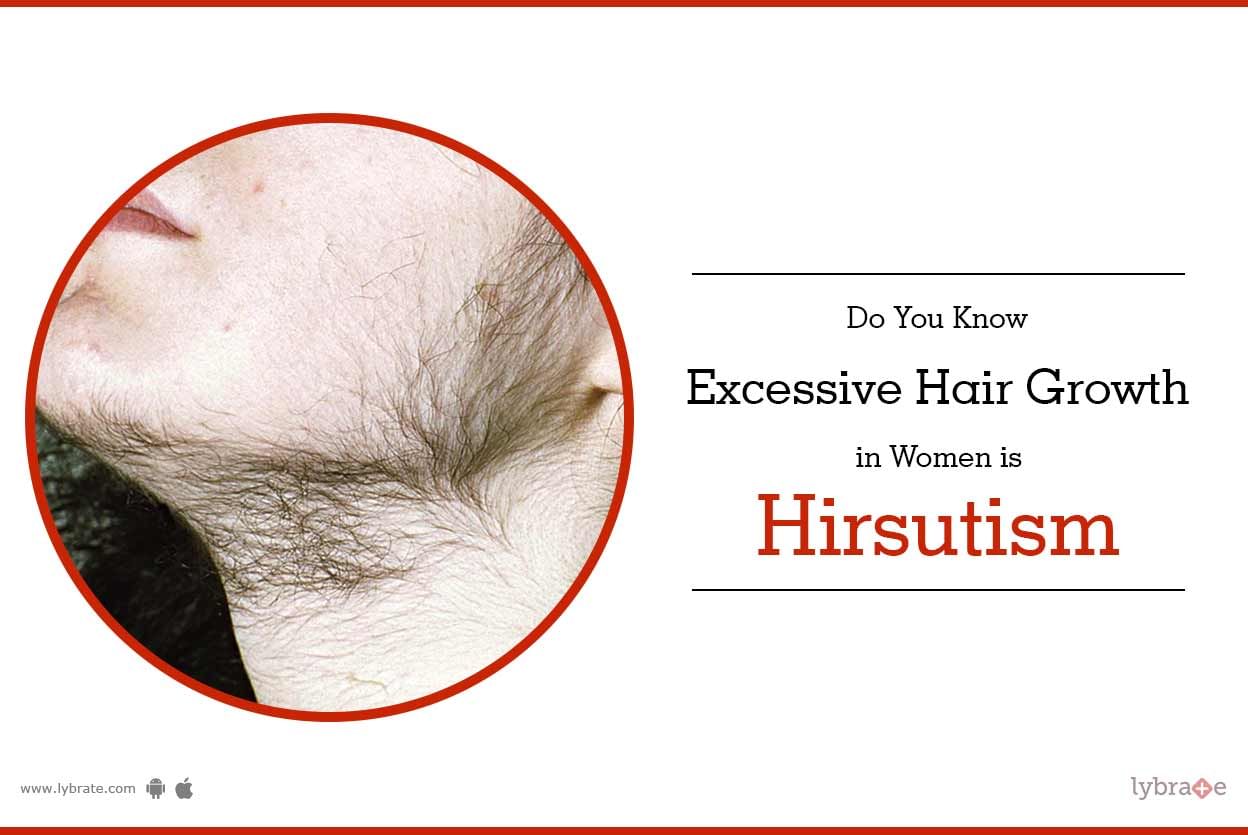 Do You Know Excessive Hair Growth in Women is Hirsutism